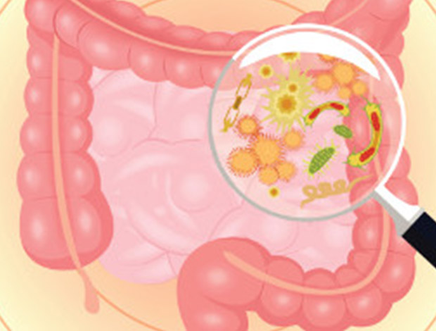 Gut microbiota composition reflects disease severity and dysfunctional immune responses in patients with COVID-19 